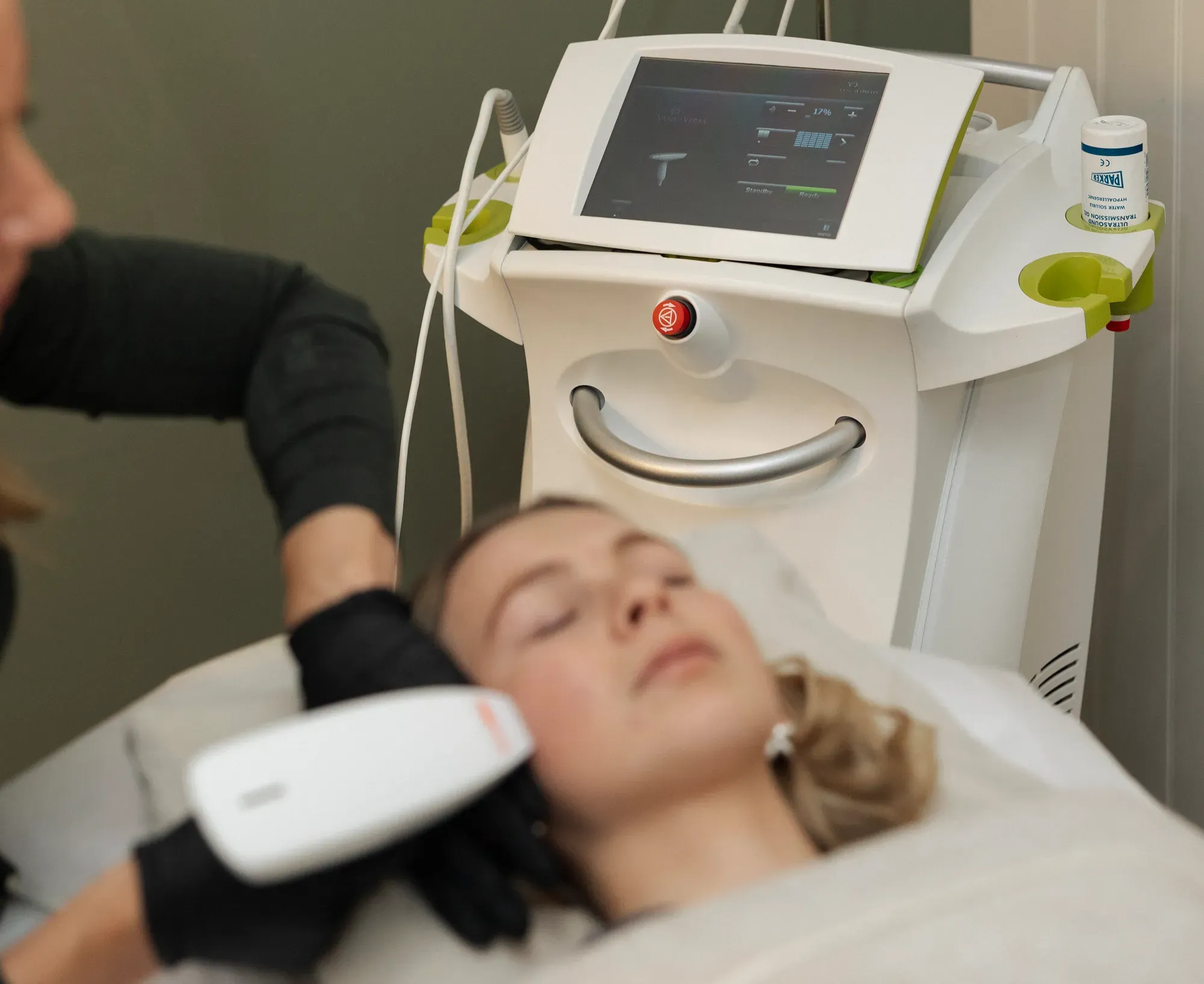 A nano fractional RF treatment at Skindepth Perth